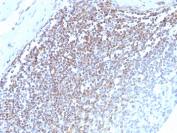 IHC staining of FFPE human spleen tissue with E2F4 antibody (clone E2F4/8984R). HIER: boil tissue sections in pH 9 10mM Tris with 1mM EDTA for 20 min and allow to cool before testing.~