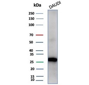 Western blot testing of human Daudi cell lysate with Haptoglobin antibody (clone HP/4813). Predicted molecular weight: 35-40 kDa (beta chain), 45-50 kDa (alpha + beta chain).~
