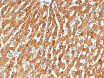 IHC staining of FFPE human liver