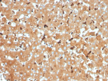 IHC staining of FFPE human liver tissue