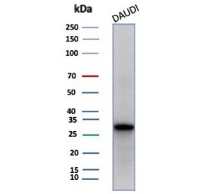 Western blot testing of human Daudi cell lysate with Haptoglobin (HP) antibody (clone HP/3834). Predicted molecular weight: 35-40 kDa (beta chain), 45-50 kDa (alpha + beta chain).~