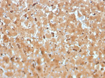 IHC staining of FFPE human liver tissue with Haptoglobin a