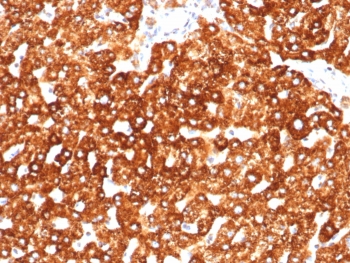 IHC staining of FFPE human liver tissue with Haptoglobin antibody (clone HP/3838). HIER: boil tissue sections in pH 9 10mM Tris with 1mM EDTA for 20 min and allow to cool before testing.~
