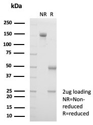 SDS-PAGE analysis of purified, BSA-free Haptoglobin
