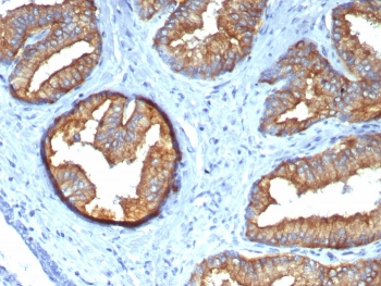 IHC staining of FFPE prostate tissue with Beta Tubulin antibody (clone TUBB/4470). HIER: boil tissue sections in pH 9 10mM Tris with 1mM EDTA for 20 min and allow to cool before testing.~