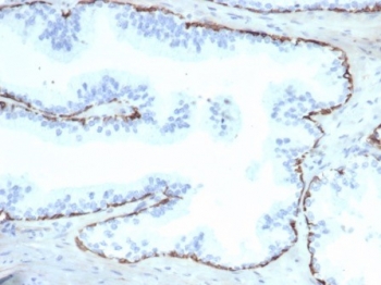IHC staining of FFPE human prostate tissue with Cytokeratin 14 antibody (clone KRT14/6987R). HIER: boil tissue sections in pH 9 10mM Tris with 1mM EDTA for 20 min and allow to cool before testing.~