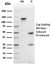 SDS-PAGE analysis of purified, BSA-free CCL18
