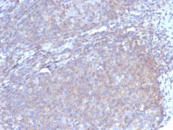 IHC staining of FFPE human lymph node tissue with G-CSF antibody (clone CSF3/4597). HIER: boil tissue sections in pH 9 10mM Tris with 1mM EDTA for 20 min and allow to cool before testing.~