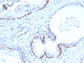 IHC staining of FFPE human prostate tissue with CK10 antibody (clone KRT10/6961). HIER: boil tissue sections in pH 9 10mM Tris with 1mM EDTA for 20 min and allow to cool before testing.~