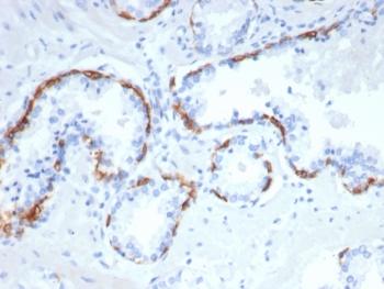 IHC staining of FFPE human prostate tissue with CK14 antibody (clone rKRT14/7290). HIER: boil tissue sections in pH 9 10mM Tris with 1mM EDTA for 20 min and allow to cool before testing.~