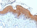 IHC staining of FFPE human skin tissue with recombinant KRT10 antibody (clone rKRT10/6923). HIER: boil tissue sections in pH 9 10mM Tris with 1mM EDTA for 20 min and allow to cool before testing.
