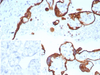 IHC staining of FFPE human placental tissue with Acidic Cytokeratin antibody (clone rKRTL/8751). Inset: PBS used in place of primary Ab (secondary Ab negative control). HIER: boil tissue sections in pH 9 10mM Tris with 1mM EDTA for 20 min and allow to cool before testing.~