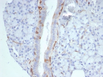 IHC staining of FFPE human prostate tissue with Cytokeratin 14 antibody (clone KRT14/7047R). HIER: boil tissue sections in pH 9 10mM Tris with 1mM EDTA for 20 min and allow to cool before testing.~