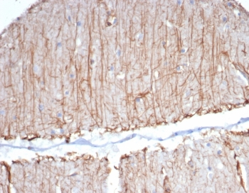 IHC staining of FFPE human brain tissue with GFAP antibody (clone GFAP/6874). HIER: boil tissue sections in pH 9 10mM Tris with 1mM EDTA for 20 min and allow to cool before testing.~