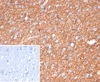 IHC staining of FFPE human brain tissue with GFAP antibo