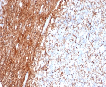 IHC staining of FFPE human cerebellum tissue with Glial Fibrillary Acidic Protein antibody (clone GFAP/6876). HIER: boil tissue sections in pH 9 10mM Tris with 1mM EDTA for 20 min and allow to cool before testing.~