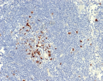 IHC staining of FFPE dog lymph node tissue with Topoisomerase II alpha antibody (clone TOP2A/7169R). HIER: boil tissue sections in pH 9 10mM Tris with 1mM EDTA for 20 min and allow to cool before testing.~