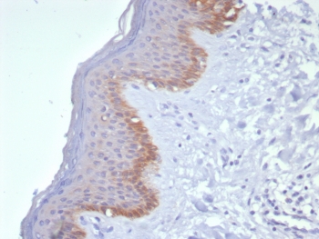 IHC staining of FFPE human skin tissue with Cytokeratin 15 antibody (clone KRT15/8312R). HIER: boil tissue sections in pH 9 10mM Tris with 1mM EDTA for 20 min and allow to cool before testing.~