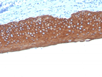 IHC staining of FFPE human tonsil tissue with Pan Cytokeratin antibody (clone MonoPoly/4999R). HIER: boil tissue sections in pH 9 10mM Tris with 1mM EDTA for 20 min and allow to cool before testing.~