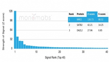 Analysis of a HuProt(TM) microarray containing more than 19,000 full-length human proteins using NME2 antibody (clone NME2/6435). Z- and S- Score: The Z-score represents the strength of a signal that a monoclonal antibody (in combination with a fluorescently-tagged anti-IgG secondary antibody) produces when b