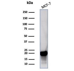 Western blot testing of human MCF-7 cell lysate with NME2 antibody (clone NME2/4160). Predicted molecular weight ~17 kDa.~