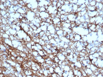 IHC staining of FFPE human cerebellum tissue with GFAP antibody (clone GFAP/6878). HIER: boil tissue sections in pH 9 10mM Tris with 1mM EDTA for 20 min and allow to cool before testing.~