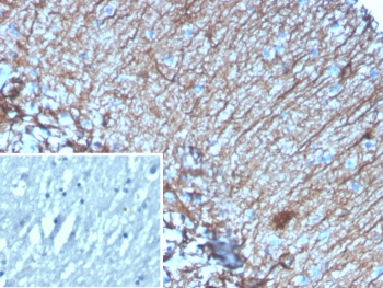 IHC staining of FFPE human brain tissue with GFAP a