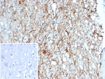 IHC staining of FFPE human brain tissue with GFAP antibody (clone GFAP/6881). Inset: PBS used in place of primary Ab (secondary Ab negative control). HIER: boil tissue sections in pH 9 10mM Tris with 1mM EDTA for 20 min and allow to cool before testing.