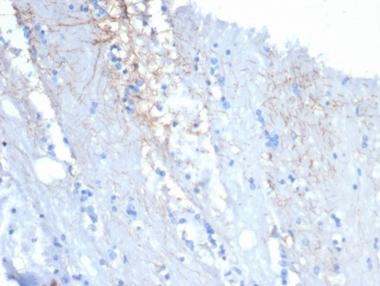 IHC staining of FFPE cow brain tissue with GFAP antibody (clone GFAP/6881). HIER: boil tissue sections in pH 9 10mM Tris with 1mM EDTA for 20 min and allow to cool before testing.