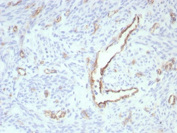 IHC staining of FFPE human uterus tissue with recombinant PECAM antibody (clone rPECAM1/8826). HIER: boil tissue sections in pH 9 10mM Tris with 1mM EDTA for 20 min and allow to cool before testing.~