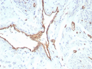 IHC staining of FFPE human uterus tissue with recombinant PECAM1 antibody (clone rPECAM1/8829). HIER: boil tissue sections in pH 9 10mM Tris with 1mM EDTA for 20 min and allow to cool before testing.~