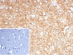 IHC staining of FFPE human brain tissue with GFAP antibody (clone GFAP/8255R). Inset: PBS used in place of primary Ab (secondary Ab negative control). HIER: boil tissue sections in pH 9 10mM Tris with 1mM EDTA for 20 min and allow to cool before testing.