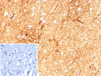 IHC staining of FFPE human brain tissue with GFAP antibody (clone GFAP/8615R). Inset: PBS used in place of primary Ab (secondary Ab negative control). HIER: boil tissue sections in pH 9 10mM Tris with 1mM EDTA for 20 min and allow to cool before testing.~