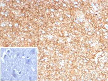 IHC staining of FFPE human brain tissue with GFAP antibody (clone GFAP/8616R). Inset: PBS used in place of primary Ab (secondary Ab negative control). HIER: boil tissue sections in pH 9 10mM Tris with 1mM EDTA for 20 min and allow to cool before testing.~