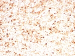 IHC staining of FFPE human spleen tissue with MPO antibody (clone rMPO/8694). HIER: boil tissue sections in pH 9 10mM Tris with 1mM EDTA for 20 min and allow to cool before testing.