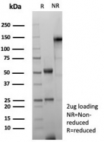 SDS-PAGE analysis of purified, BSA-free recombinant GFAP antibody (clone rGFAP/8685) as confirmation of integrity and purity.