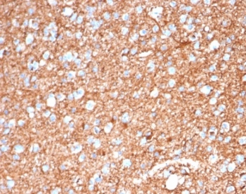IHC staining of FFPE human brain tissue with GFAP antibody (clone GFAP/6886). HIER: boil tissue sections in pH 9 10mM Tris with 1mM EDTA for 20 min and allow to cool before testing.