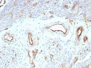 IHC staining of FFPE human uterus tissue with recombinant PECAM-1 antibody (clone rPECAM1/8827). HIER: boil tissue sections in pH 9 10mM Tris with 1mM EDTA for 20 min and allow to cool before testing.~