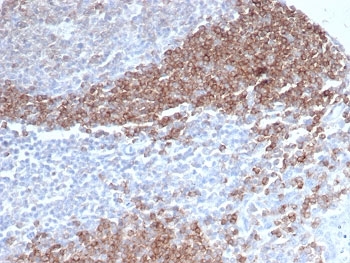 IHC staining of FFPE human tonsil tissue with CD79b antibody (clone CD79b/4960). HIER: boil tissue sections in pH 9 10mM Tris with 1mM EDTA for 20 min and allow to cool before testing.~
