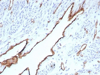 IHC staining of FFPE human placental tissue with CD31 antibody (clone rPECAM1/8832). HIER: boil tissue sections in pH 9 10mM Tris with 1mM EDTA for 20 min and allow to cool before testing.~