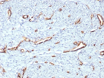 IHC staining of FFPE human uterus tissue with CD31 antibody (clone C31/8359R). HIER: boil tissue sections in pH 9 10mM Tris with 1mM EDTA for 20 min and allow to cool before testing.~