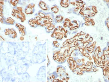 IHC staining of FFPE human placental tissue with CD31 a