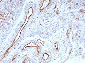 IHC staining of FFPE human uterus tissue with CD31 antibody (clone rPECAM1/8830). HIER: boil tissue sections in pH 9 10mM Tris with 1mM EDTA for 20 min and allow to cool before testing.~