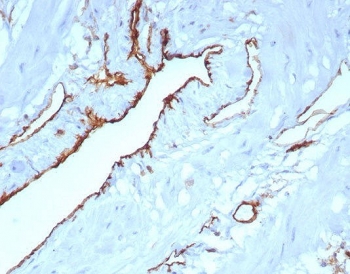 IHC staining of FFPE human uterus tissue with CD31 antibody (clone C31/8242R). HIER: boil tissue sections in pH 9 10mM Tris with 1mM EDTA for 20 min and allow to cool before testing.~