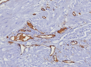 IHC staining of FFPE human uterus tissue with CD31 antibody (clone C31/8377R). HIER: boil tissue sections in pH 9 10mM Tris with 1mM EDTA for 20 min and allow to cool before testing.