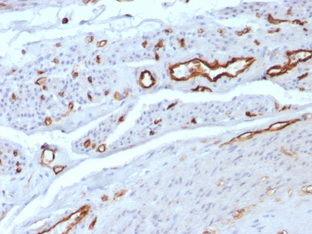 IHC staining of FFPE human uterus tissue with CD31 antibody (clone C31/8592R). HIER: boil tissue sections in pH 9 10mM Tris with 1mM EDTA for 20 min and allow to cool before testing.~