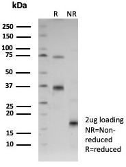 SDS-PAGE analysis of purified, BSA-free CD31 antibody (