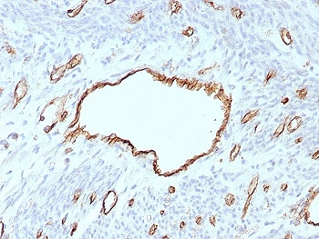 IHC staining of FFPE human uterus tissue with PECAM-1 antibody (clone C31/8593R). HIER: boil tissue sections in pH 9 10mM Tris with 1mM EDTA for 20 min and allow to cool before testing.~