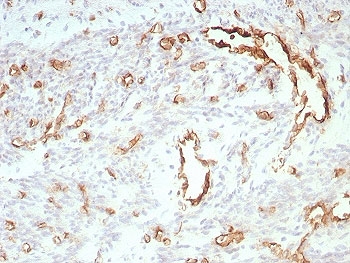 IHC staining of FFPE human uterus tissue with PECAM-1 antibody (clone C31/8828R). HIER: boil tissue sections in pH 9 10mM Tris with 1mM EDTA for 20 min and allow to cool before testing.~