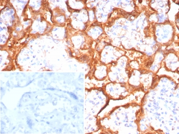 IHC staining of FFPE human placental tissue with Growth Hormone antibody (clone GH/8215R). Inset: PBS used in place of primary Ab (secondary Ab negative control). HIER: boil tissue sections in pH 9 10mM Tris with 1mM EDTA for 20 min and allow to cool before testing.~